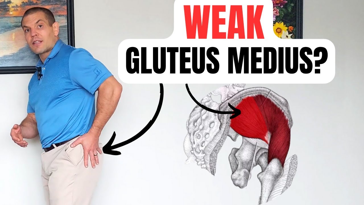 Gluteus Medius Weakness: Causes and Solutions for 50