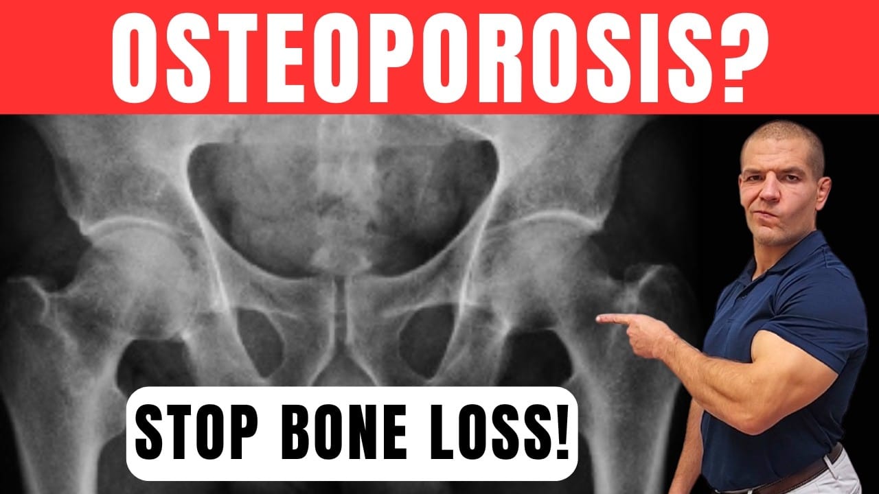 Osteoporosis? Try These Simple Tips to Strengthen Your Bones