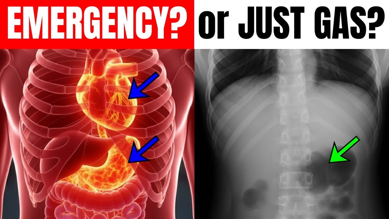 Pain Under Left Rib Cage: Emergency Signs and Relief Tips