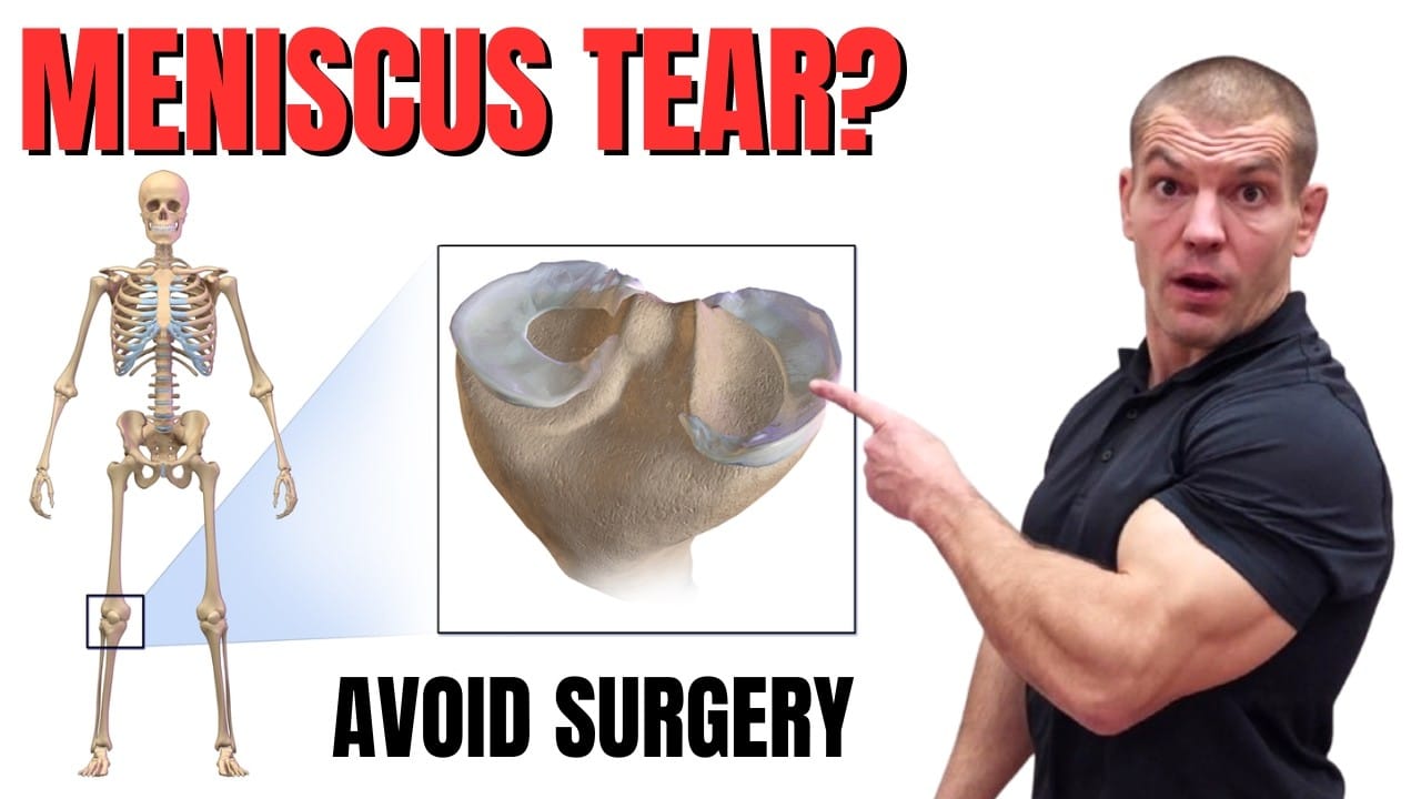 Meniscus Tear? Effective Exercises to Avoid Surgery