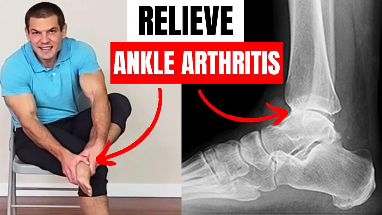 Top 10 Exercises for Ankle Arthritis Relief and Mobility