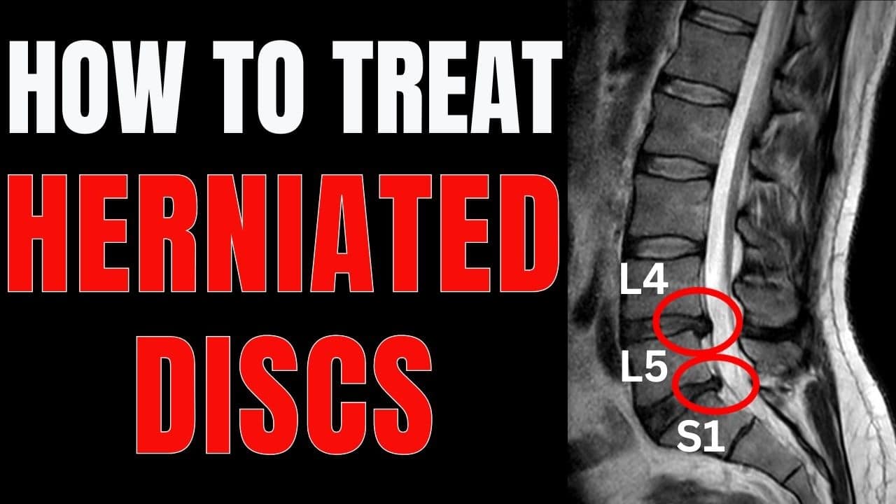 Effective Tips for Herniated Disc Relief at L4-L5 or L5-S1