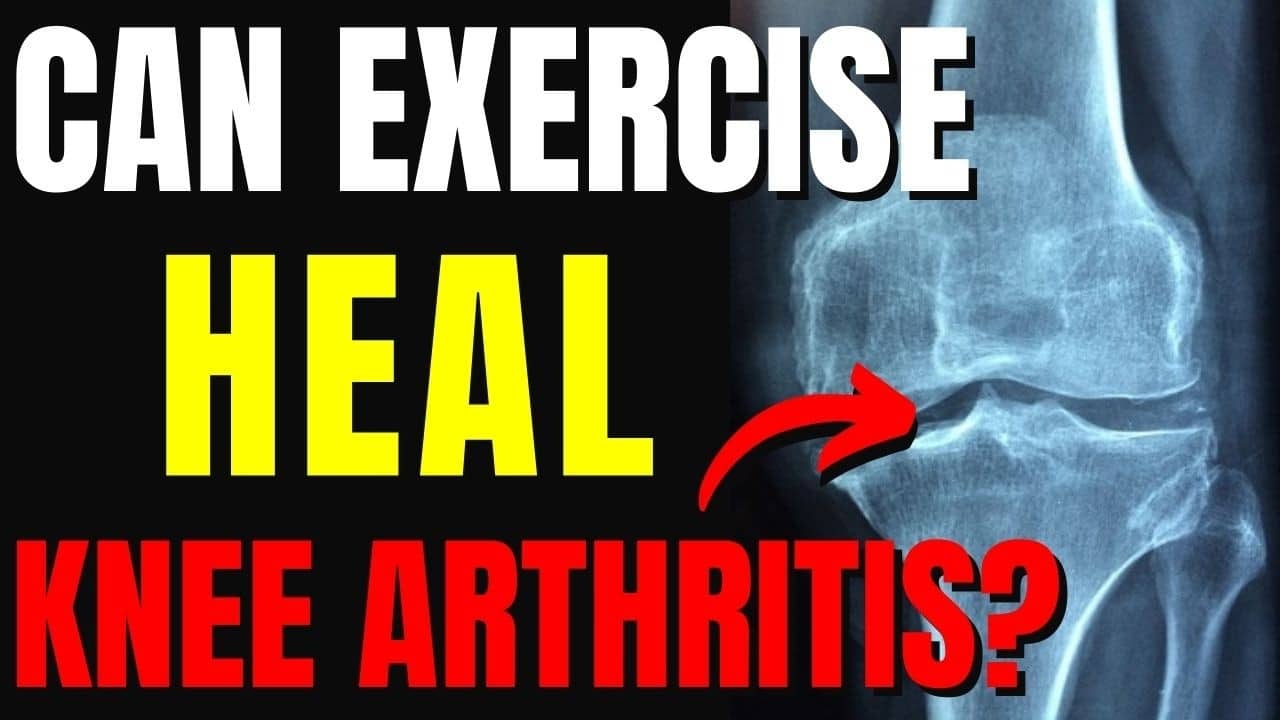 Heal Knee Arthritis with Pain-Free Exercises