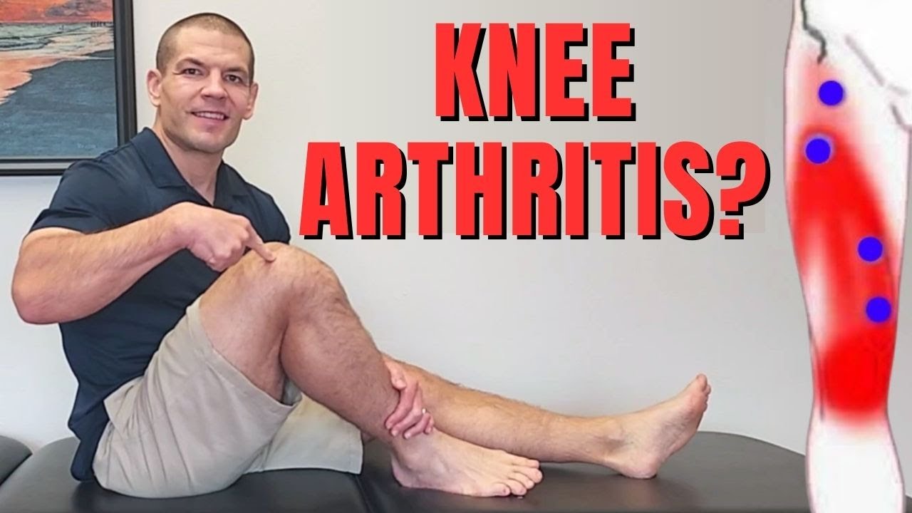 Knee Arthritis: Avoid Surgery by Identifying Muscle Knots