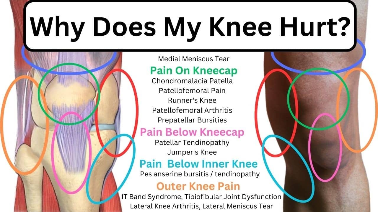 Understanding Knee Pain by Location: Causes