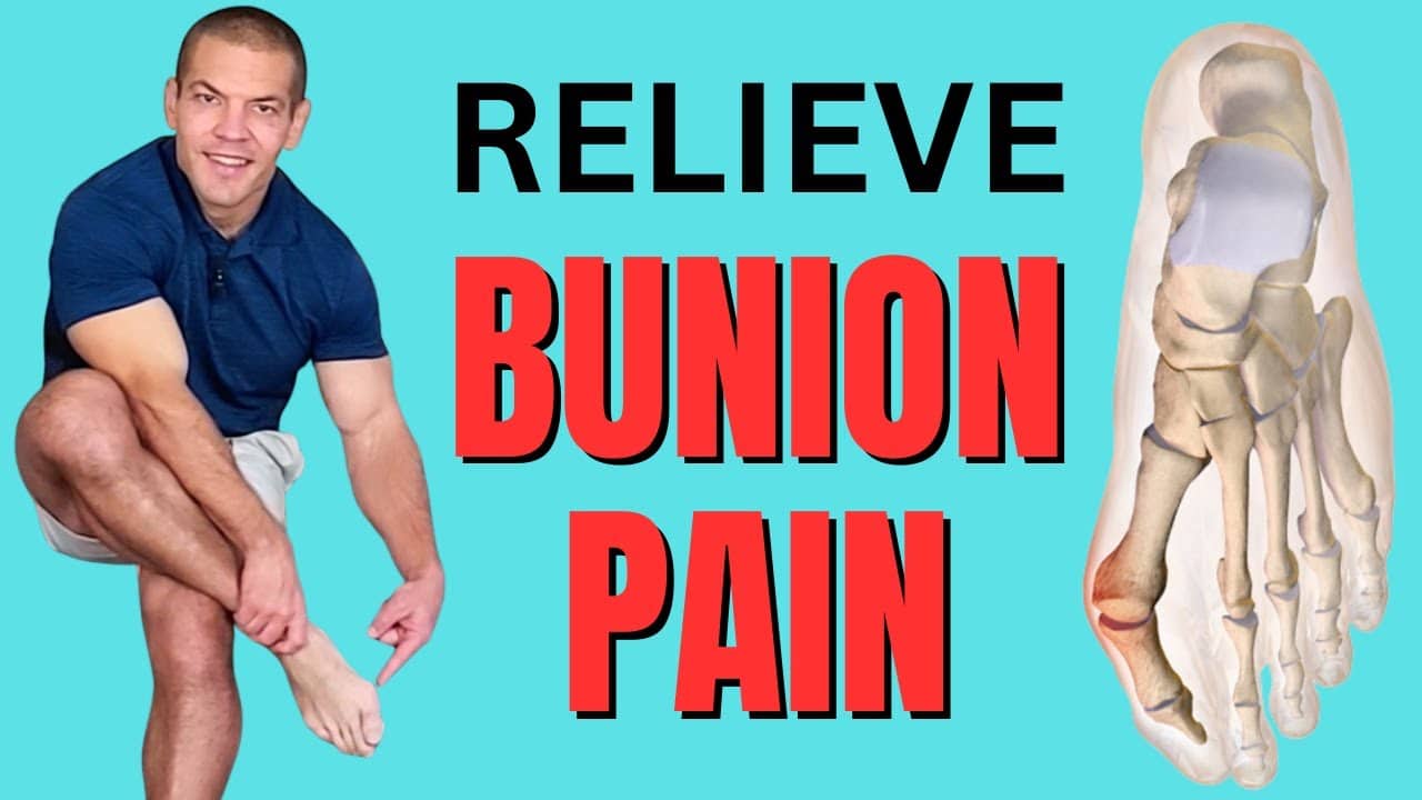 5 Secret Tricks to Treat Bunion Pain in Big Toe Without Surgery