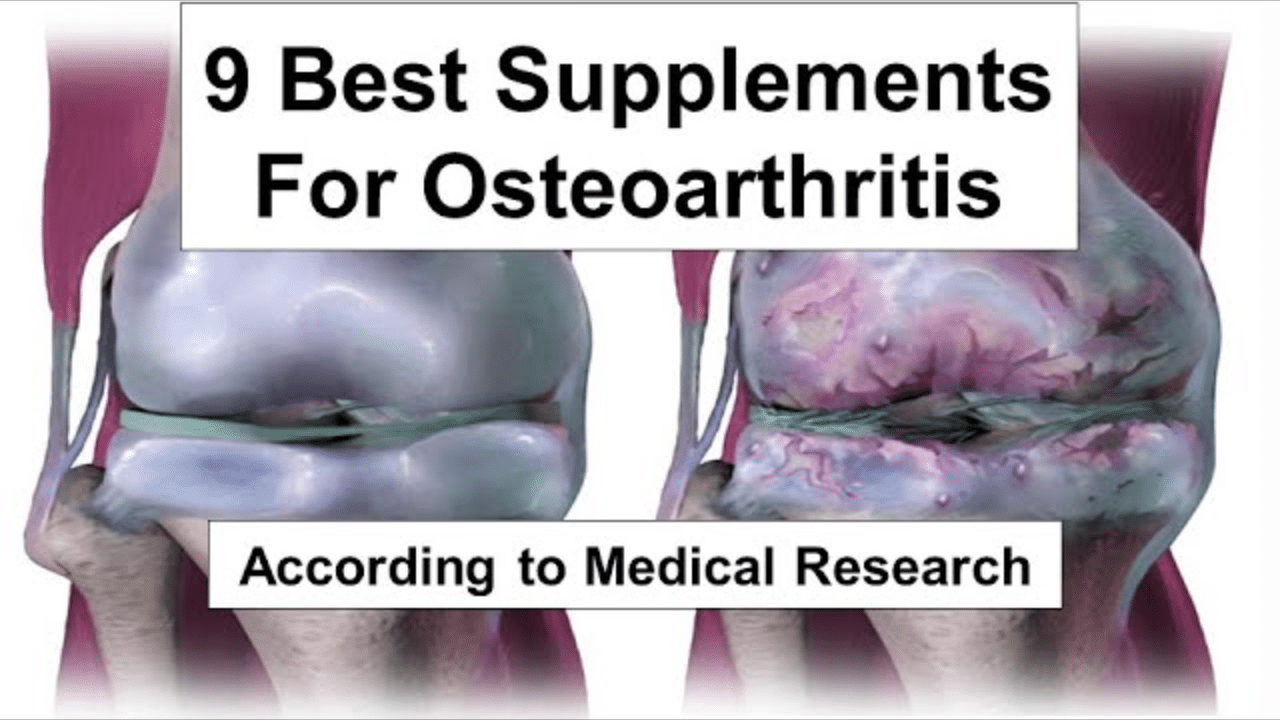 9 Best Supplements for Osteoarthritis