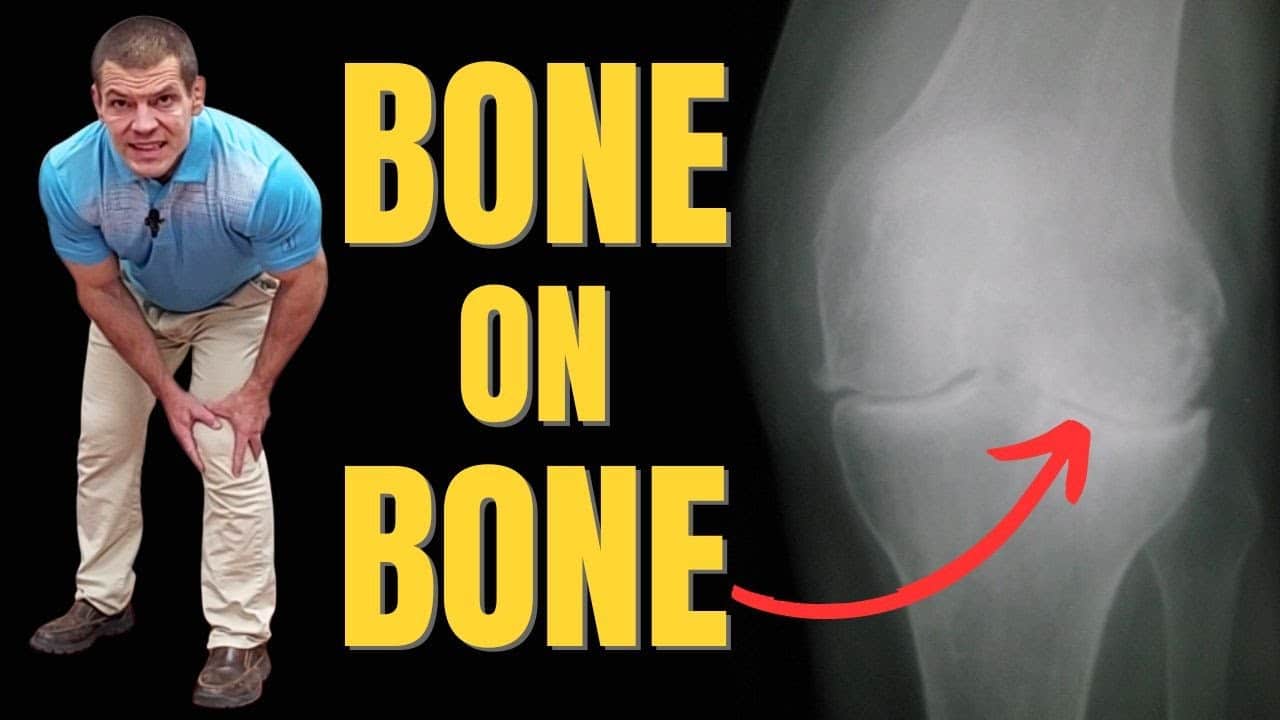 Effective Strategies for Bone on Bone Knee Pain Relief