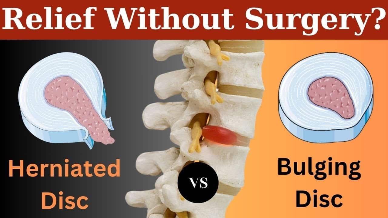 Herniated Disc vs Disc Bulge: Key Differences