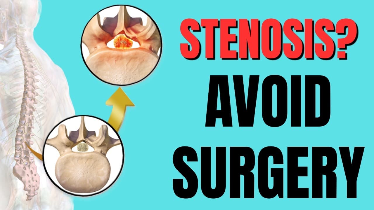 Natural Relief for Spinal Stenosis Without Surgery