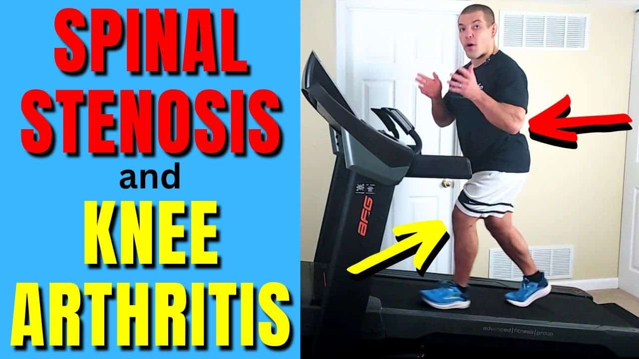 Surprising Benefits of Incline Treadmill Walking for Knee Pain