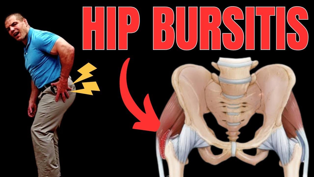 Essential Exercises for Hip Bursitis Recovery