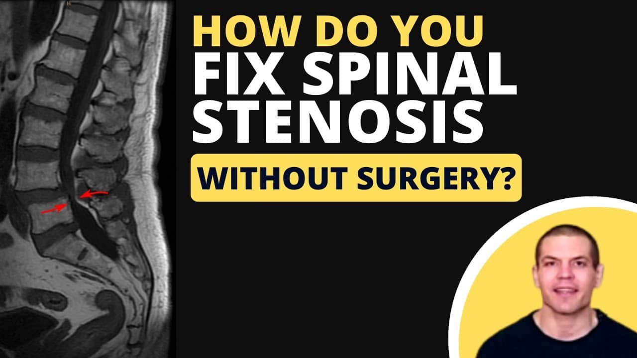 Fix Spinal Stenosis Without Surgery: 5 Essential Exercises