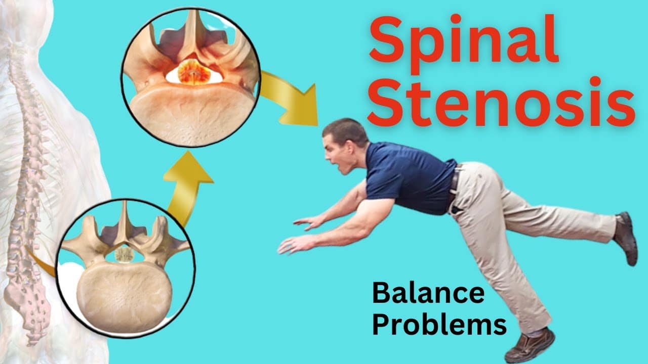 Spinal Stenosis and Balance Problems: 3 Key Solutions