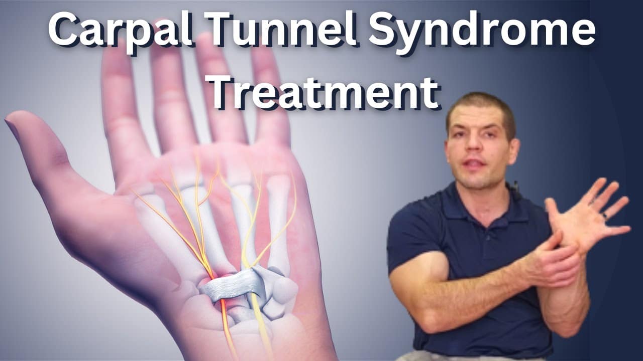 Effective Carpal Tunnel Syndrome Treatment Options