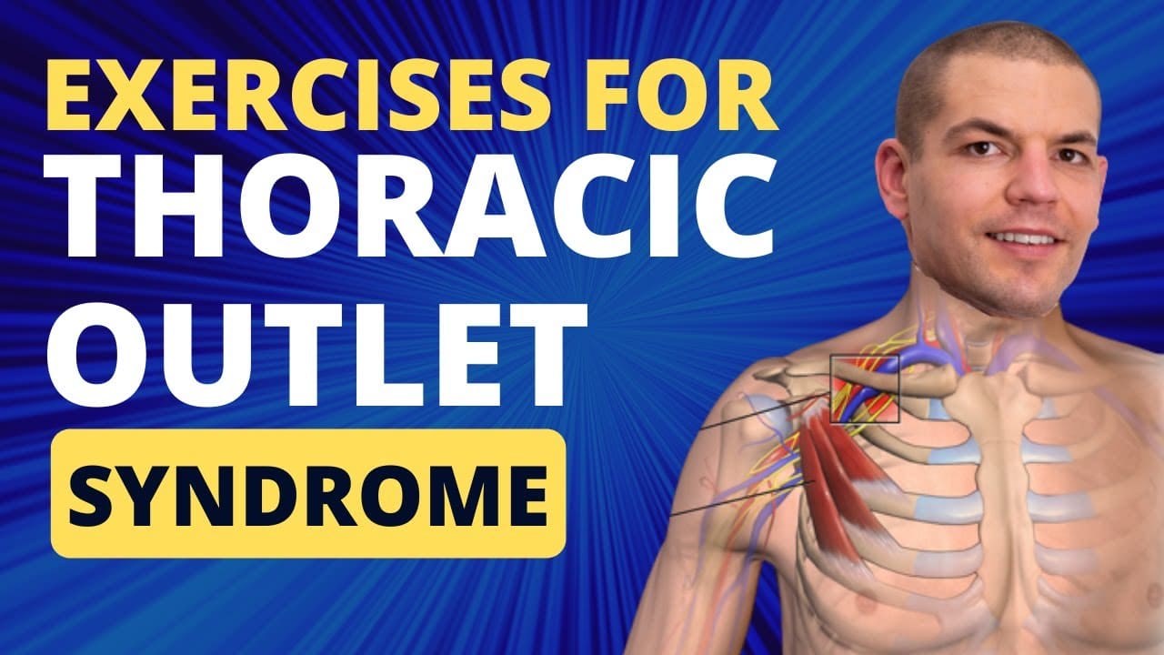 Effective Exercises for Thoracic Outlet Syndrome Relief